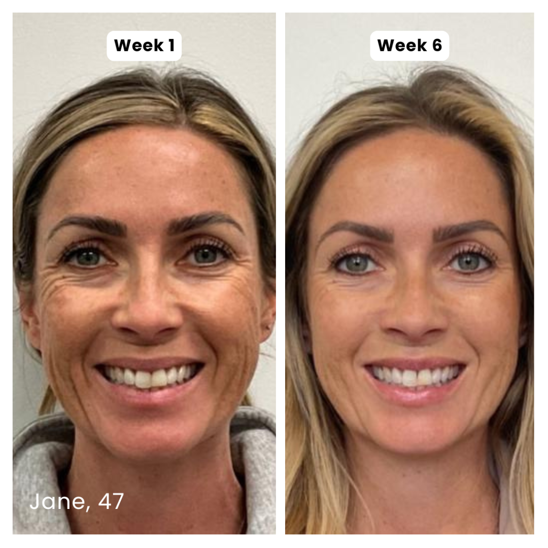 Prequel Anti-Aging Silicone Scar-Stick