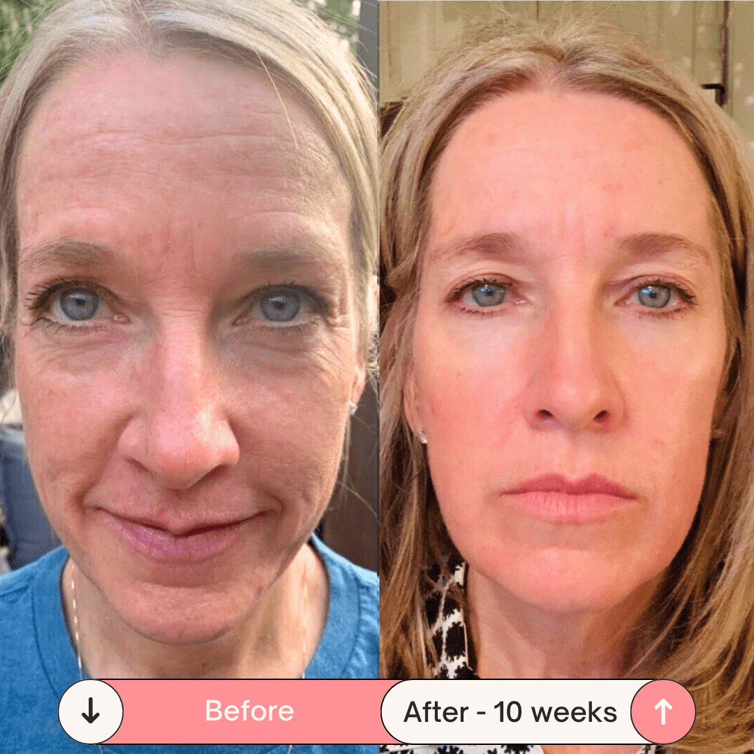 DermaPulse 2.0 – Skin Rejuvenation Wand - ZYRA