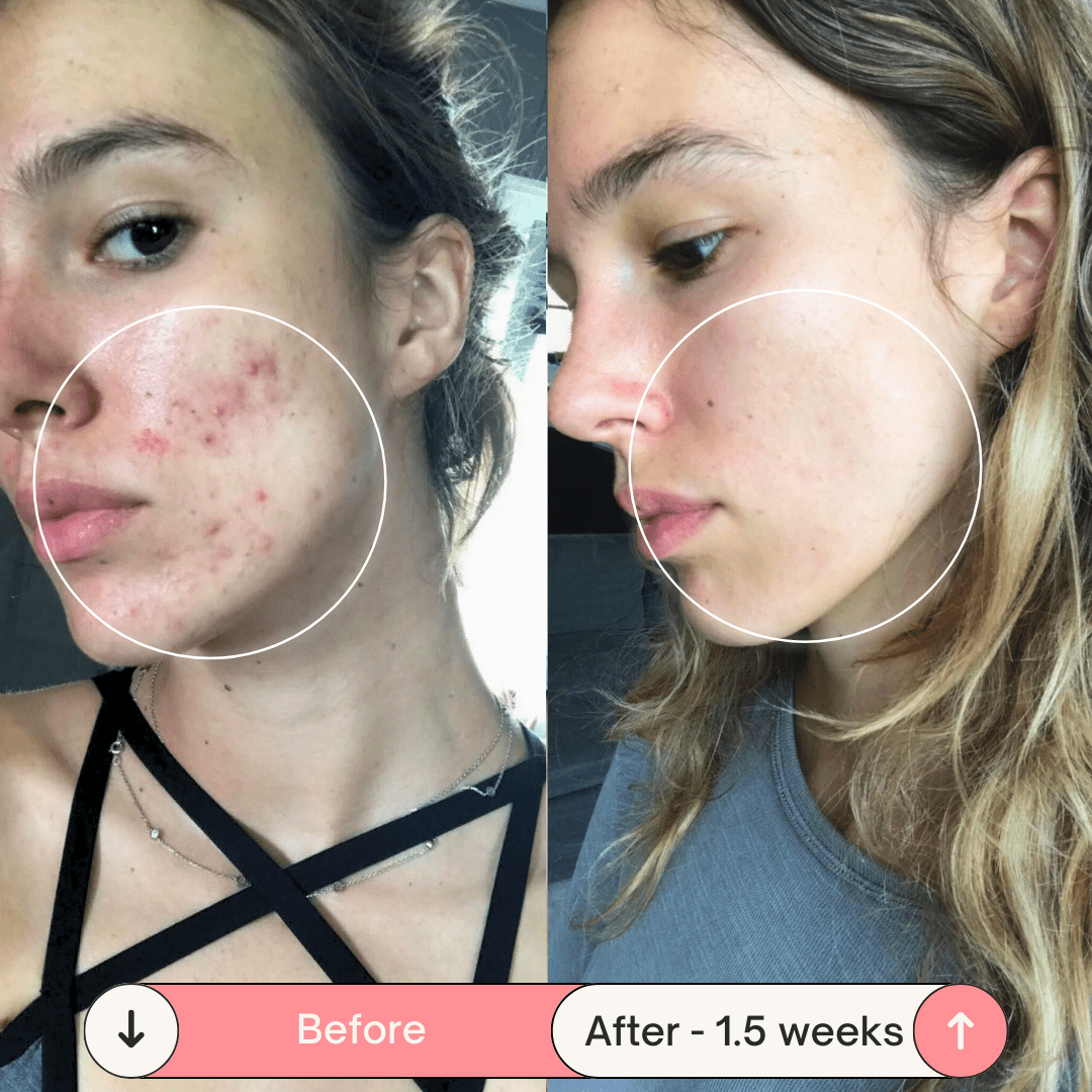 DermaPulse 2.0 – Skin Rejuvenation Wand - ZYRA