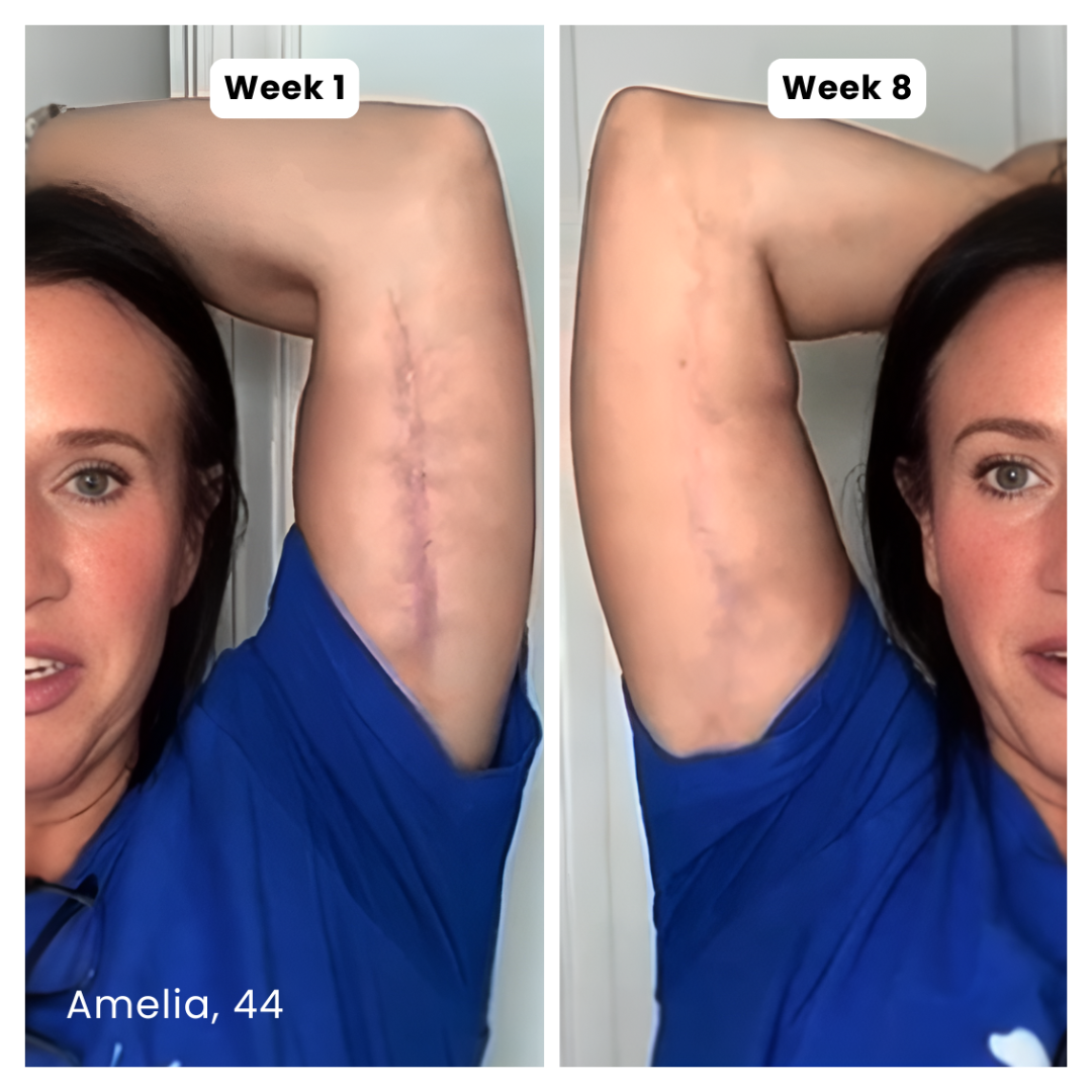 Prequel Anti-Aging Silicone Scar-Stick