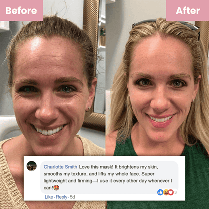 Glass Skin Collagen Mask - ZYRA