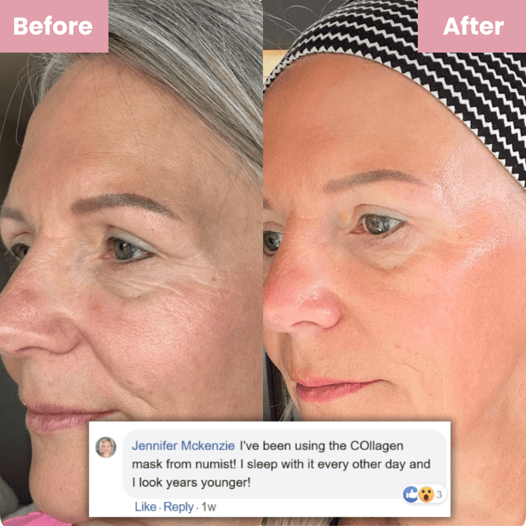 Glass Skin Collagen Mask - ZYRA