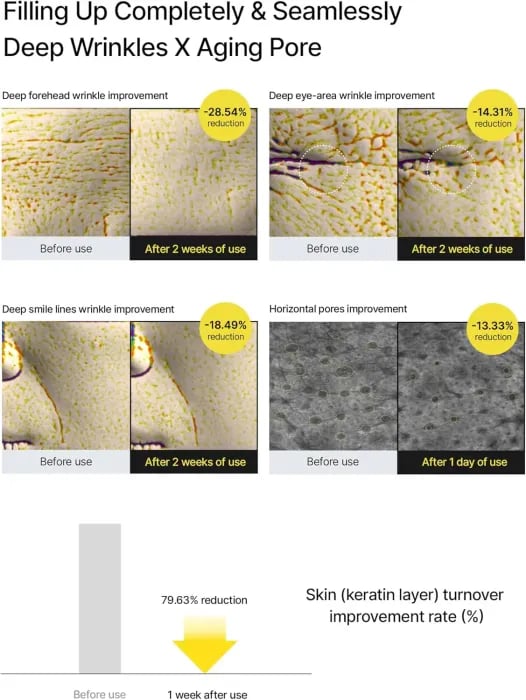 The Vita - A Retinal Shot Tightening Booster - ZYRA