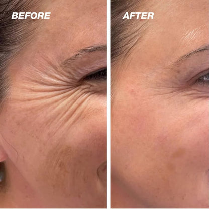 The Vita - A Retinal Shot Tightening Booster - ZYRA