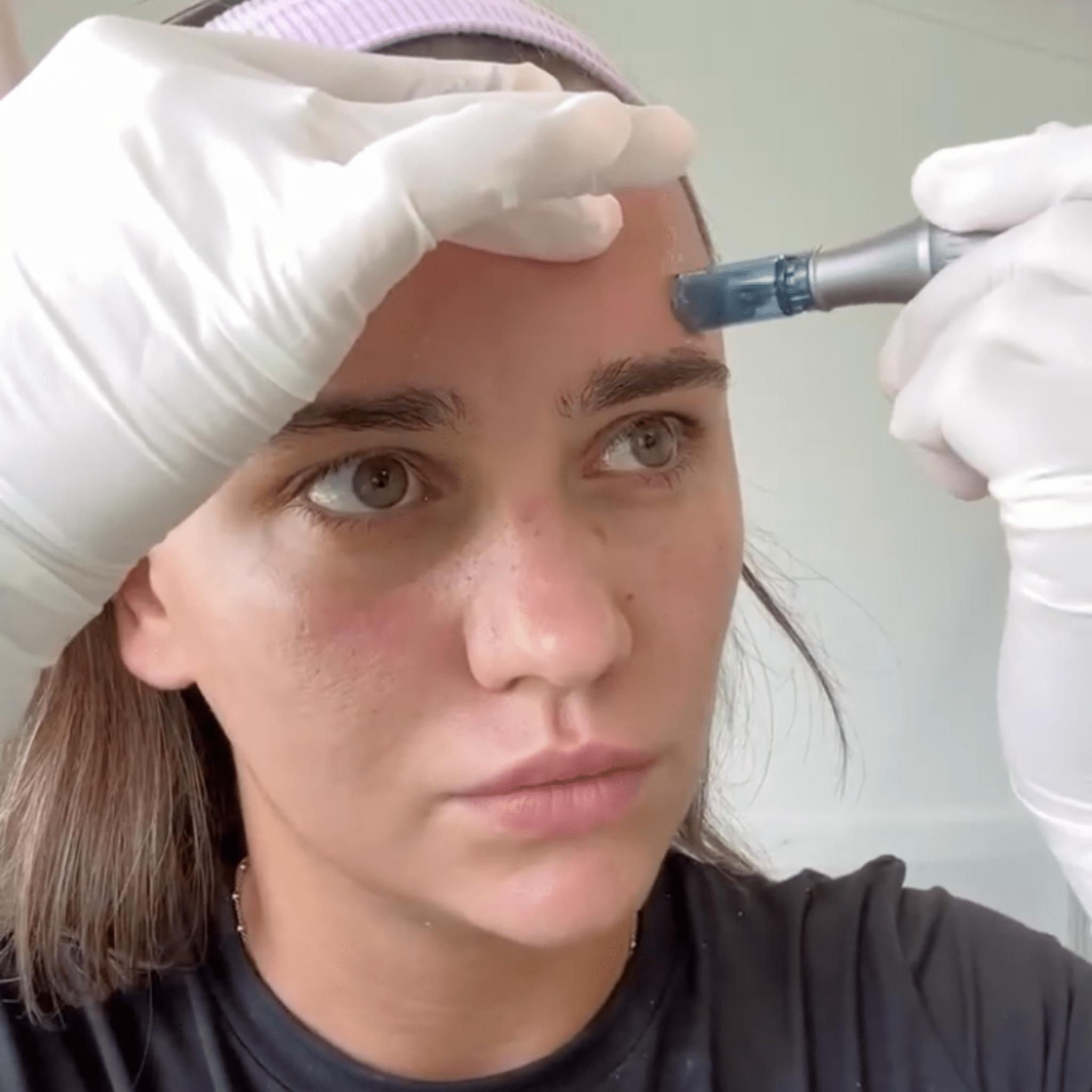 ZYRA Rejuvenating Pen - ZYRA